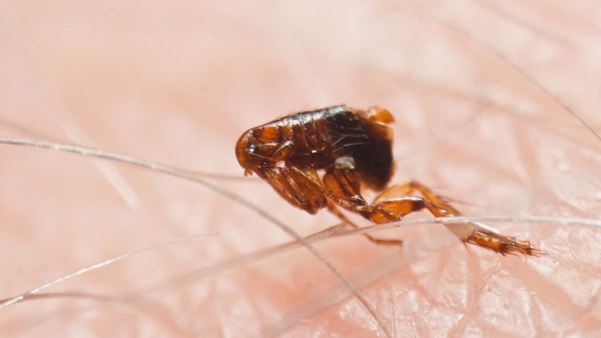Waspada, Kutu Rambut Bisa Picu Serangan Jantung