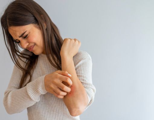 Gejala Eksim yang Perlu Anda Ketahui