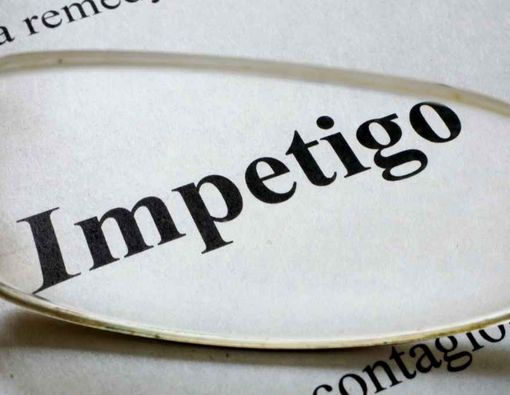 Mengenal 5 Gejala Impetigo, Infeksi Kulit yang Bisa Menular