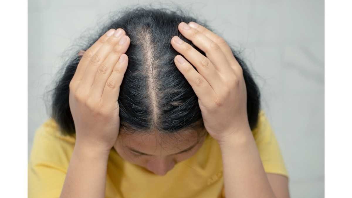 Dampak Psikologis Rambut Rontok pada Wanita