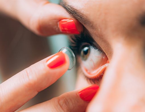 Penggunaan Softlens Dapat Menyebabkan Kanker Mata?