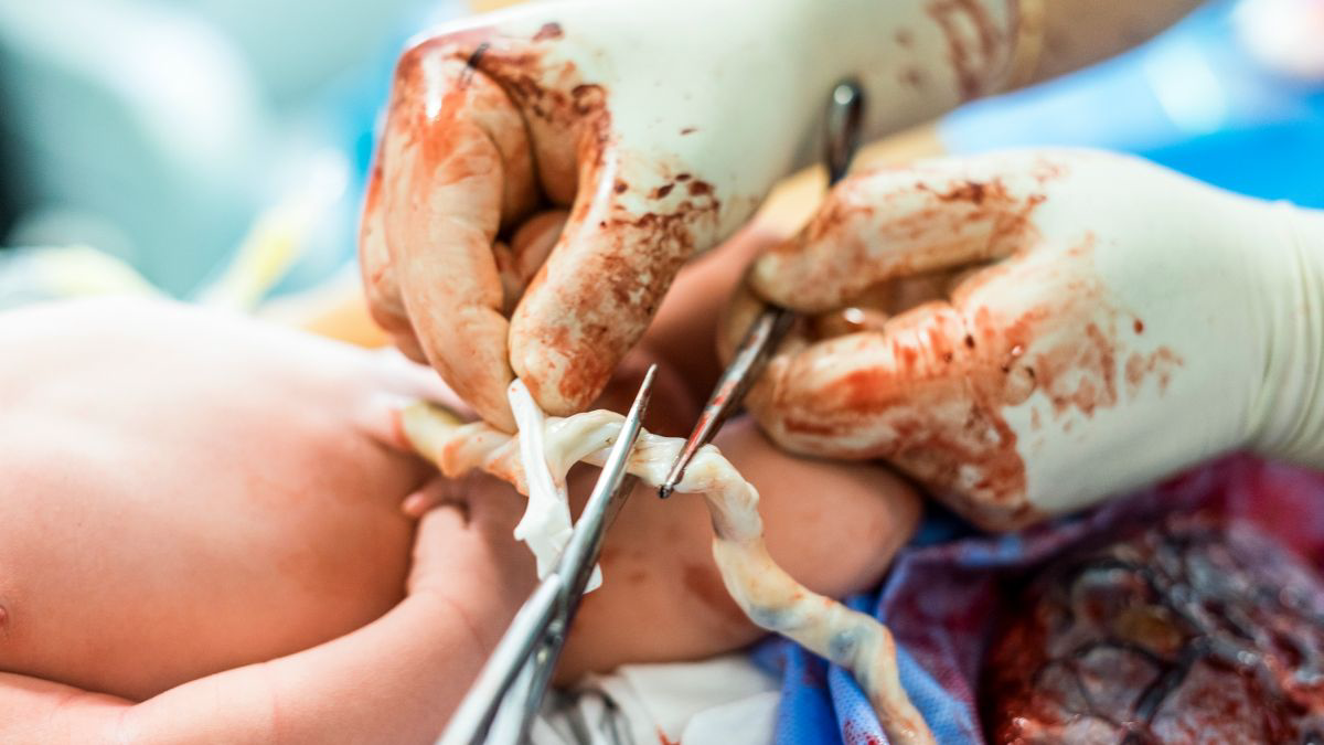 Masalah Plasenta yang Umum Terjadi