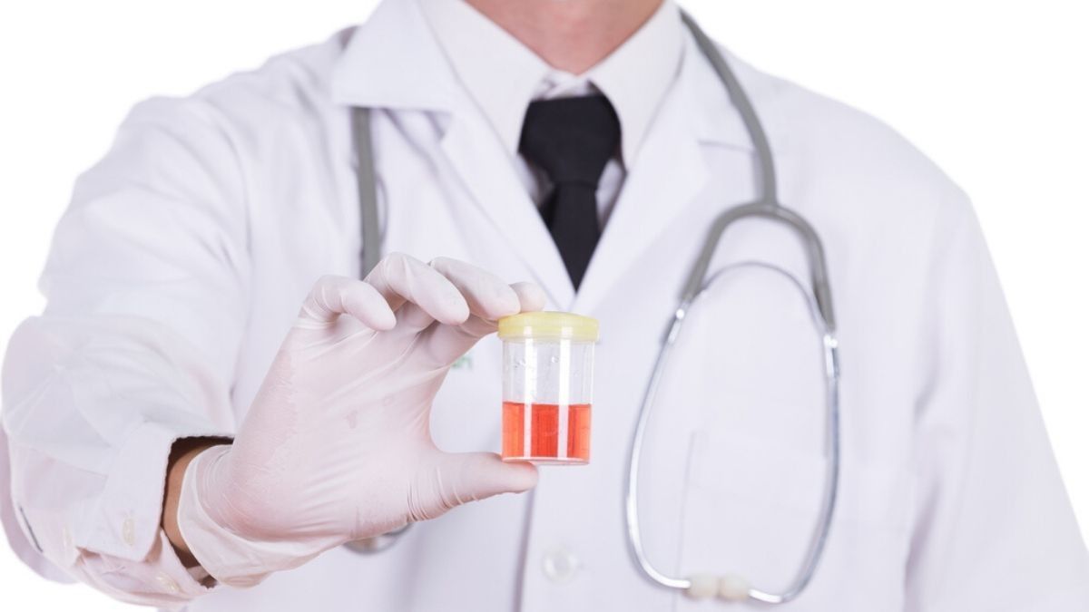 Pertolongan Pertama Saat Menemukan Darah di Urine