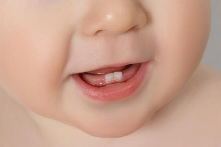 Tanda-Tanda Si Kecil Akan Tumbuh Gigi