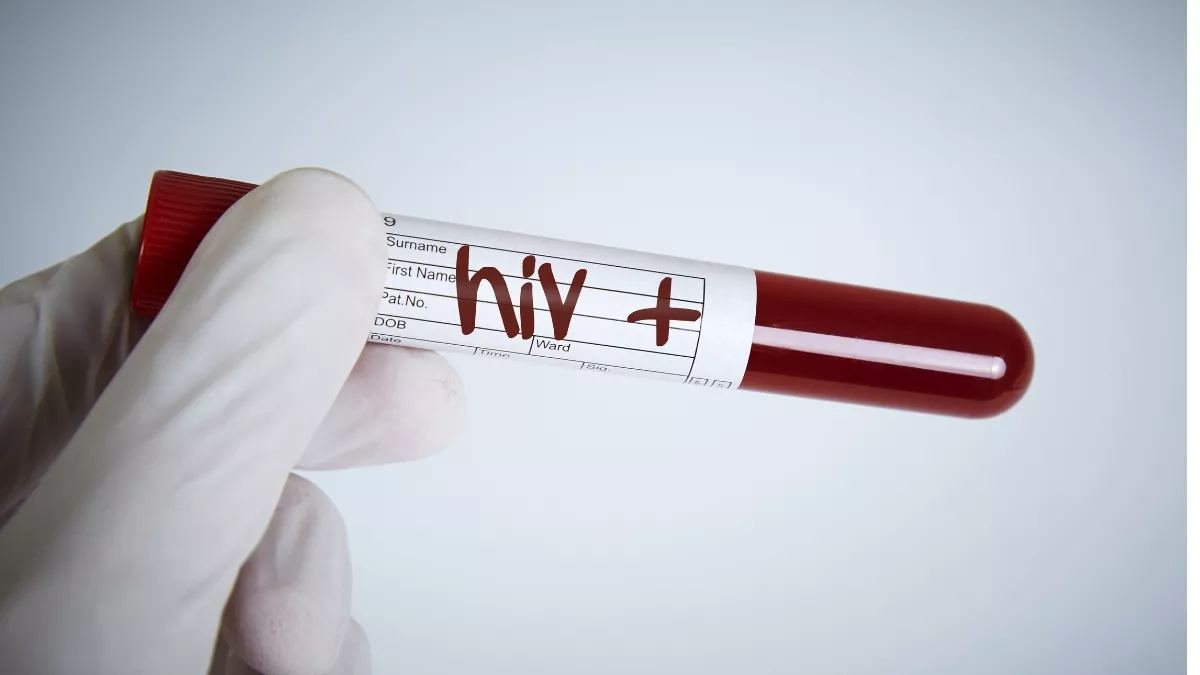 Hasil Tes HIV Reaktif (Positif), Ini 10 Hal yang Harus Kamu Lakukan