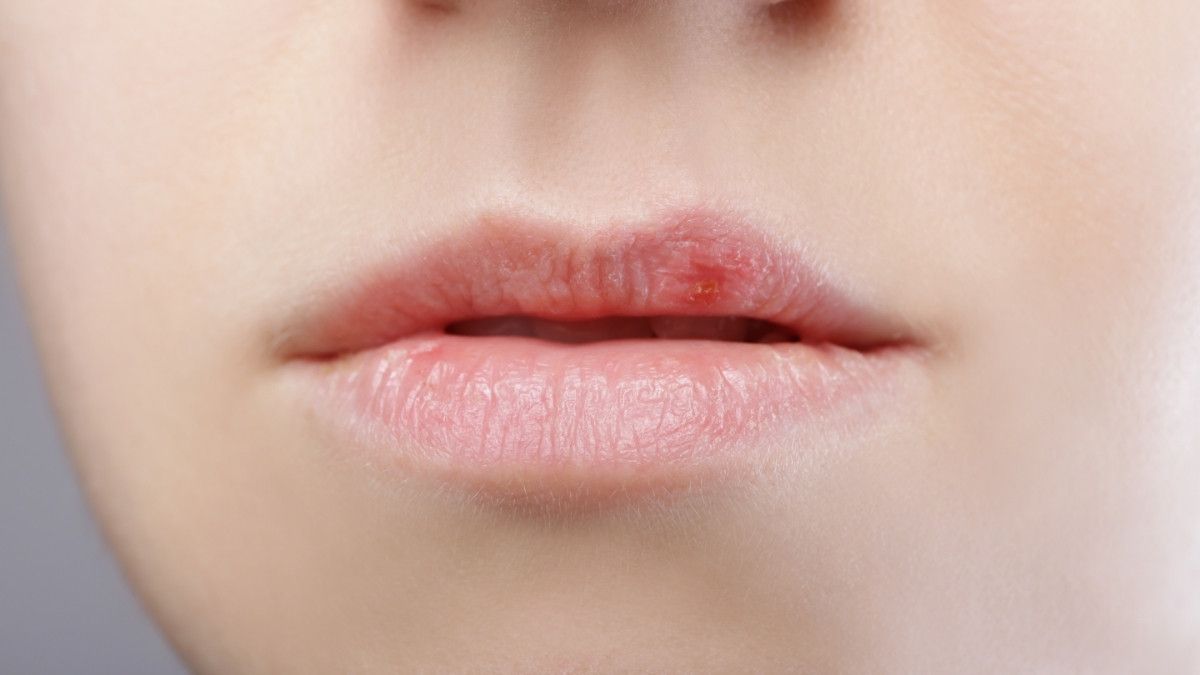 Онкология губы симптомы