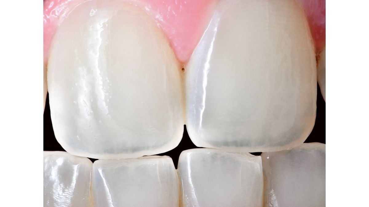 Apa Sebenarnya Fungsi Gigi Seri? Ini Faktanya