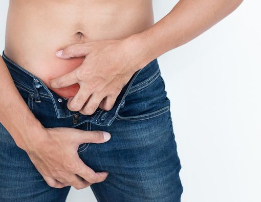 Kurap Muncul di Daerah Penis, Kok Bisa?