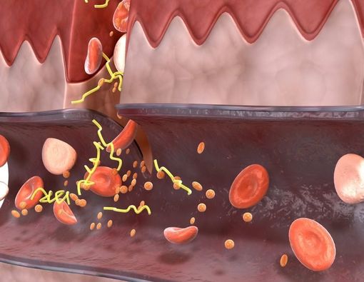 Pemicu Kerusakan Pembuluh Darah Pengidap Diabetes Tipe 2