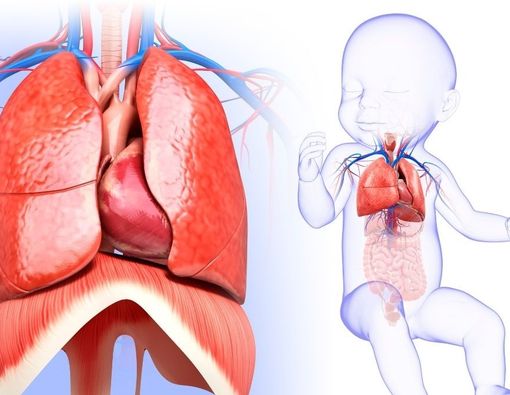Kenali dan Waspadai Bronchopulmonary Dysplasia pada Bayi