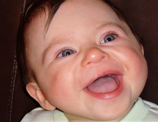 Bayi Sindrom Williams Rentan Stunting?