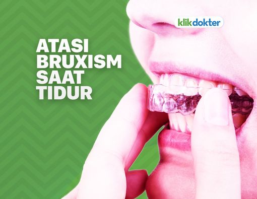 Pentingnya Pelindung Gigi Ketika Tidur