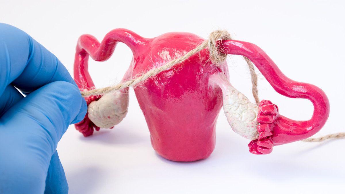 Mengenal Kontrasepsi Tubektomi yang Ampuh Cegah Kehamilan