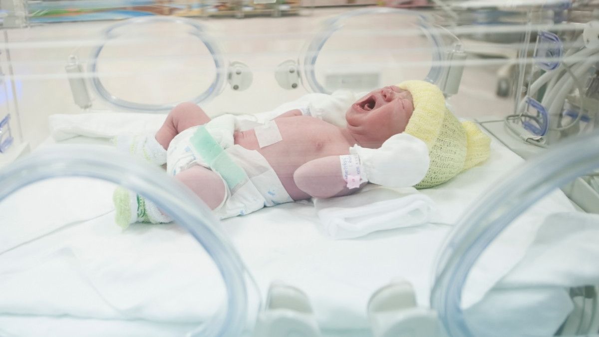Penyebab Transient Tachypnea Neonatal pada Bayi Baru Lahir