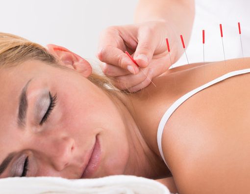 Benarkah Akupunktur Bisa Menurunkan Berat Badan?