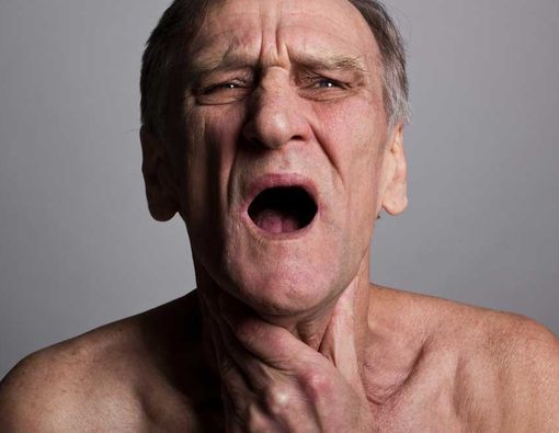 Mengapa Lansia Rentan Kena Alergi?