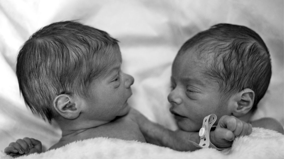 Punya Anak Kembar, Waspada Twin Anemia Polycythemia Sequence