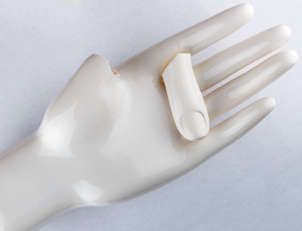 Bisakah Kusta Sembuh Total?