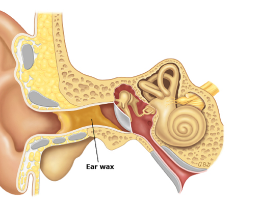 5 Ciri Anda Memiliki Telinga Bermasalah