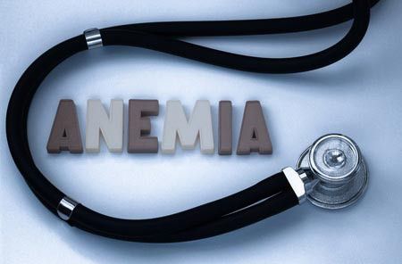 Anemia Berbahaya! Kenali Gejalanya