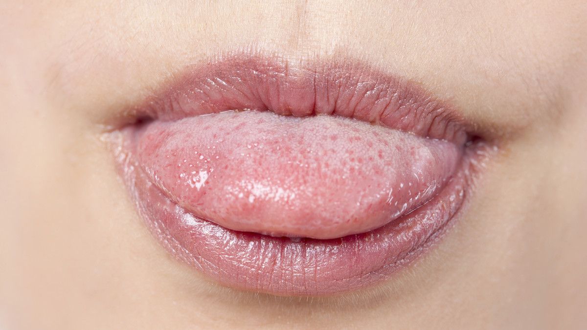 5 Penyebab Rasa Logam di Mulut Terkait Diabetes KlikDokter