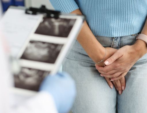 6 Gejala Miom pada Wanita