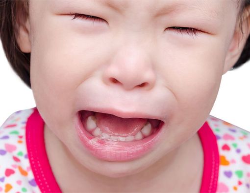 Cara Mudah dan Efektif Mengatasi Sariawan pada si Kecil