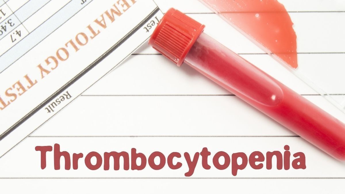 Trombositopenia Penyebab, Gejala, Pengobatan KlikDokter