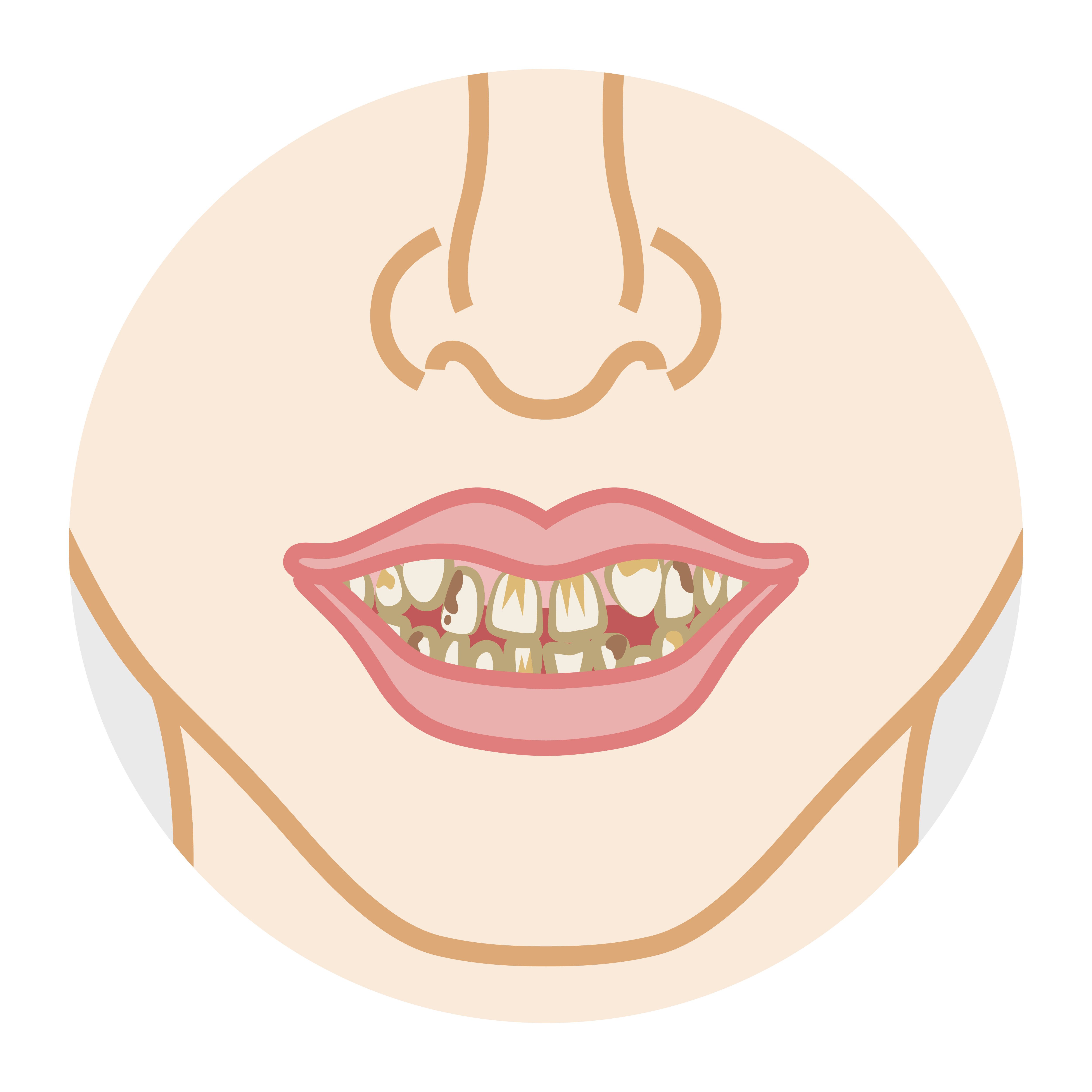Kondisi Gigi Buruk Bisa Sebabkan Kanker Mulut?