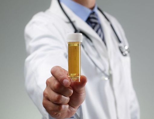 5 Penyakit Ini Bikin Urine Berbau Menyengat