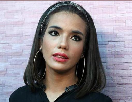 Alami Kecelakaan, Sheila Marcia Akan Menjalani Operasi