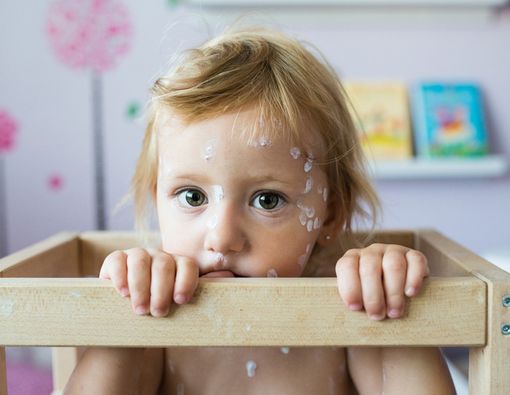 Bolehkah Mandi Saat Terkena Cacar Air?