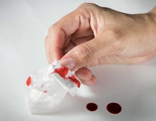 Efektifkah Manfaat Tisu Magic untuk Membersihkan Luka?