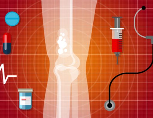 Kelebihan Konsumsi Vitamin D Picu Kanker Tulang?