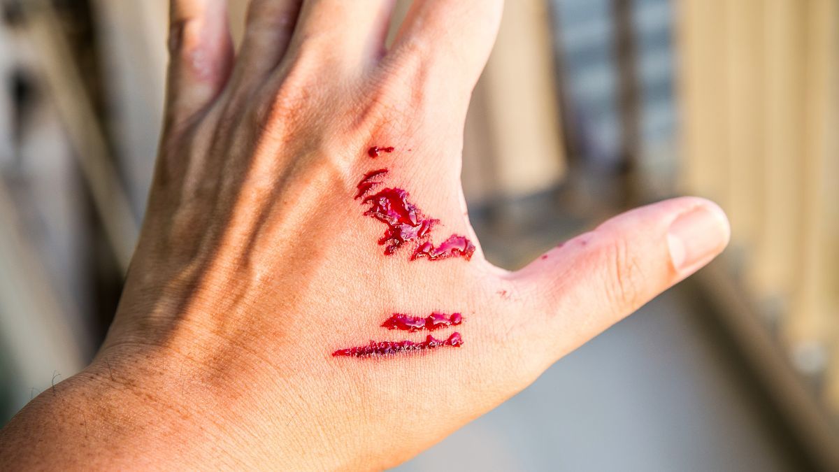 vaksin rabies