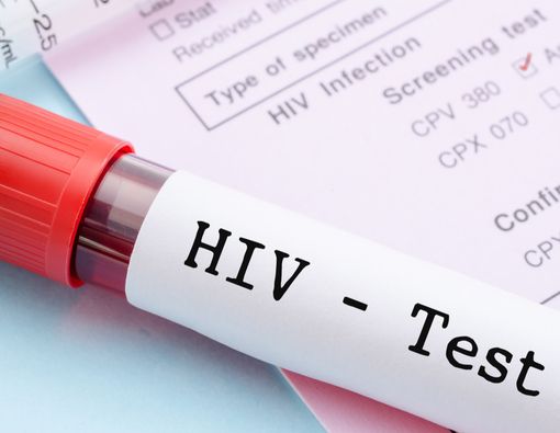 Jenis-jenis Tes HIV yang Wajib Anda Tahu