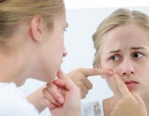 6 Kebiasaan yang Membuat Jerawat Semakin Gawat