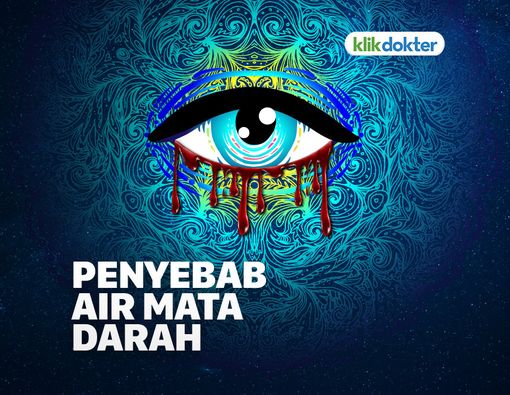 Air Mata Darah, Gejala Penyakit Apa Ini?