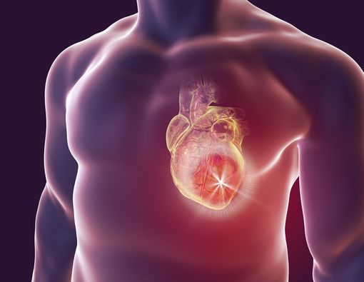 Kenali Beda Gagal Jantung, Henti Jantung, dan Serangan Jantung