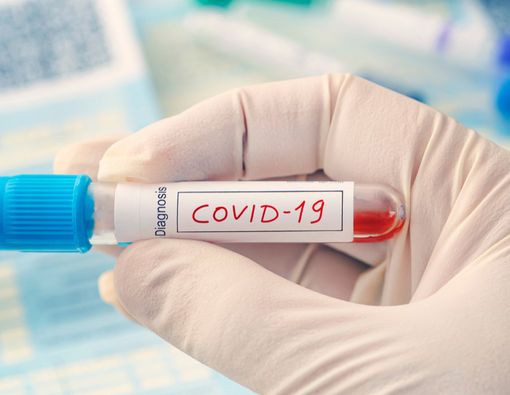 3 Perusahaan di Semarang Jadi Klaster Baru Penyebaran COVID-19