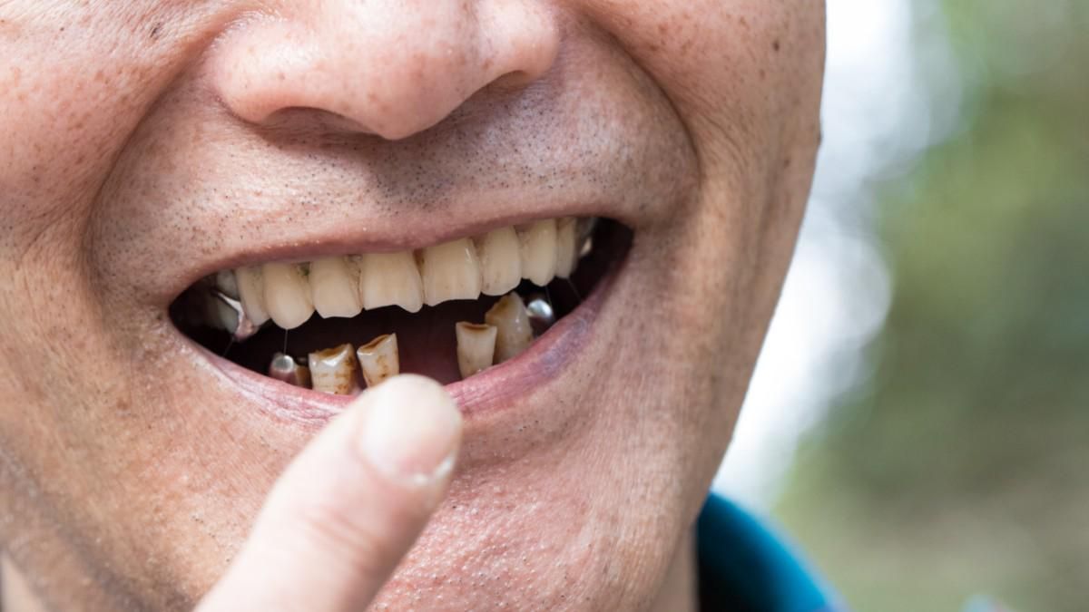 Amankah Penggunaan Obat Penumbuh Gigi?