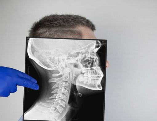 Bagian-Bagian Tulang Tengkorak Manusia dan Fungsinya