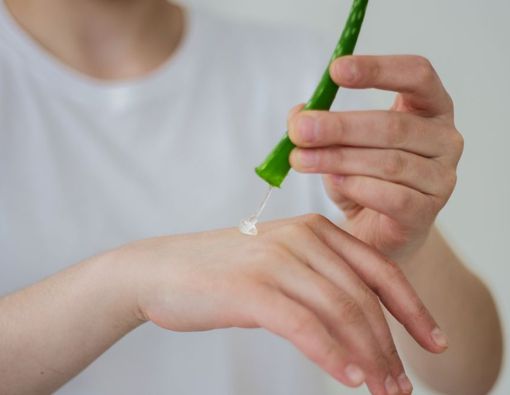 Mengobati Biduran dengan Lidah Buaya, Efektifkah?