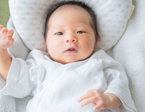 Penyebab Mata Bayi Kuning