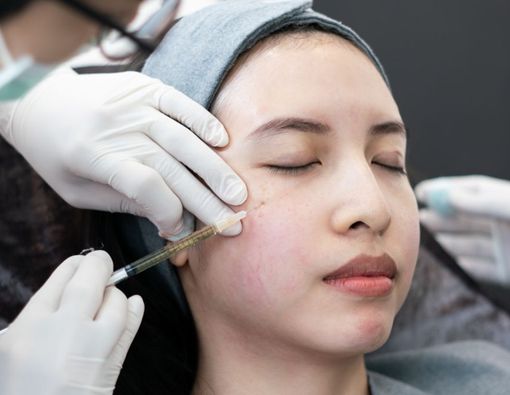 Mengenal Prosedur Suntik Botox untuk Kulit Kencang dan Cerah