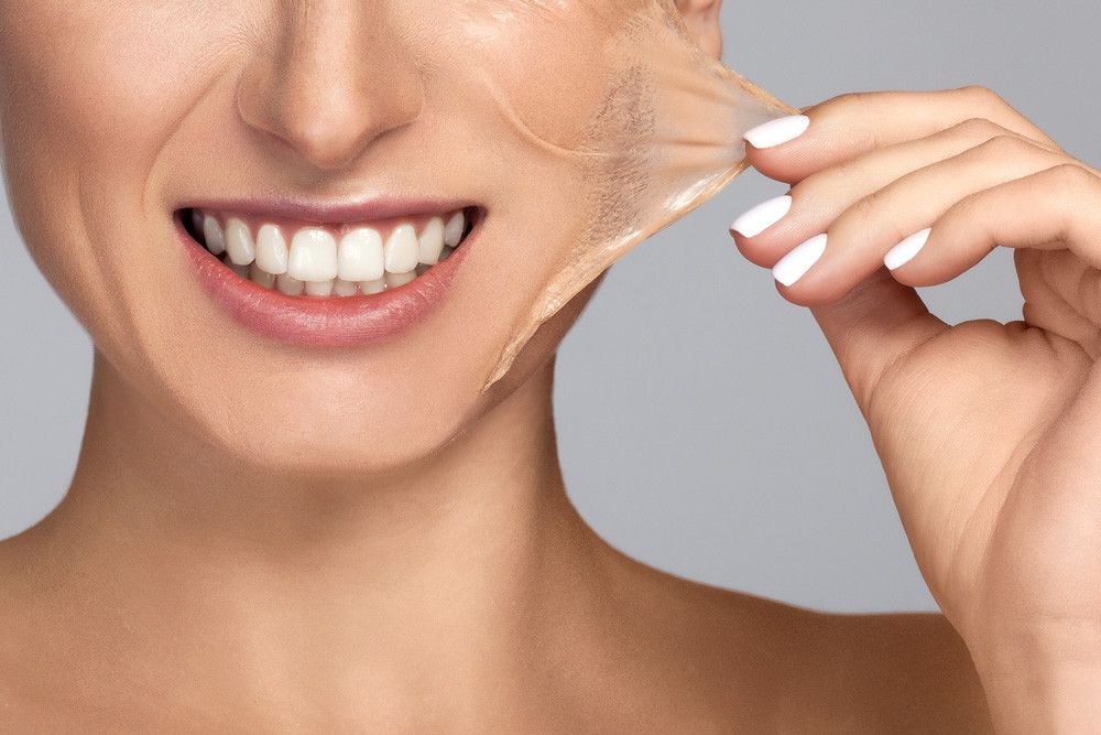 Wajah Cerah Seketika Berkat Micropeel