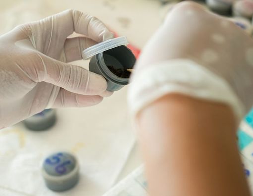 Prosedur Tes Kultur Tinja untuk Deteksi Gangguan Perut