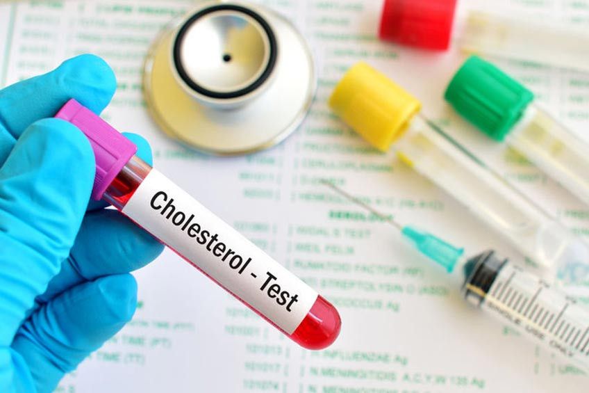 Periksa Kolesterol Sendiri vs. Periksa di Laboratorium?