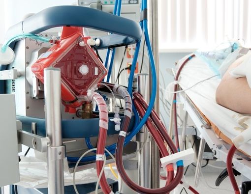 Mesin ECMO, Alat untuk Bantu Kinerja Paru-Paru dan Jantung