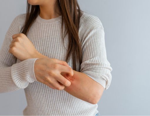 Psoriasis Bisa Tingkatkan Risiko Penyakit Jantung, Benarkah?